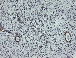 TPD52L3 Monoclonal Antibody (OTI3D11), TrueMAB , OriGene 30 &mu;L | Buy Online | Origene Technologies | Fisher Scientific