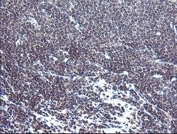 TPD52L3 Monoclonal Antibody (OTI3D11), TrueMAB , OriGene 30 &mu;L | Buy Online | Origene Technologies | Fisher Scientific