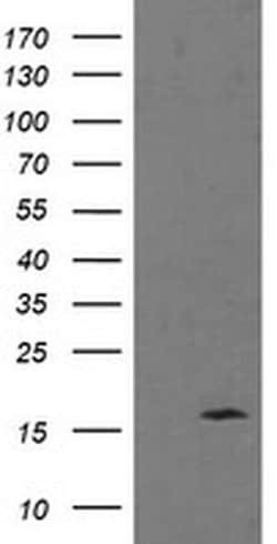 TPD52L3 Monoclonal Antibody (OTI6E1), TrueMAB , OriGene 30 &mu;L | Buy Online | Origene Technologies | Fisher Scientific
