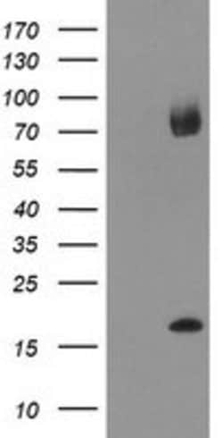 TPD52L3 Mouse anti-Human, Clone: OTI2D2, lyophilized, TrueMAB 100 &mu;g;