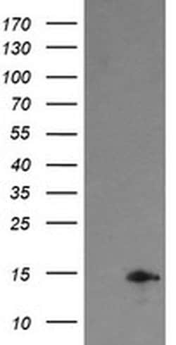 TPD52L3 Monoclonal Antibody (OTI4G6), TrueMAB , OriGene:Antibodies:Primary