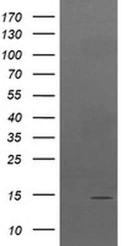 TPD52L3 Monoclonal Antibody (OTI3D11), TrueMAB , OriGene 30 &mu;L | Buy Online | Origene Technologies | Fisher Scientific