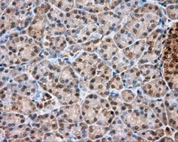 TPMT Monoclonal Antibody (OTI4C1), TrueMAB , OriGene 30 &mu;L; Unconjugated:Antibodies,