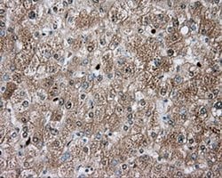 TPMT Monoclonal Antibody (OTI4C1), TrueMAB , OriGene 30 &mu;L; Unconjugated:Antibodies,