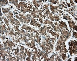 TPMT Monoclonal Antibody (OTI4C1), TrueMAB , OriGene 30 &mu;L; Unconjugated:Antibodies,