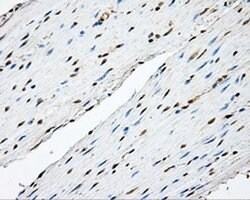 TPMT Monoclonal Antibody (OTI4B1), TrueMAB , OriGene 100 &mu;L; Unconjugated:Antibodies,