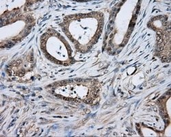 TPMT Monoclonal Antibody (OTI4B1), TrueMAB , OriGene 100 &mu;L; Unconjugated:Antibodies,