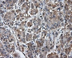 TPMT Monoclonal Antibody (OTI4B1), TrueMAB , OriGene 100 &mu;L; Unconjugated:Antibodies,