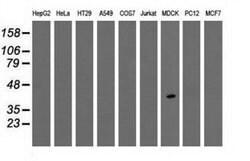 TPMT Monoclonal Antibody (OTI4C1), TrueMAB , OriGene 30 &mu;L; Unconjugated:Antibodies,