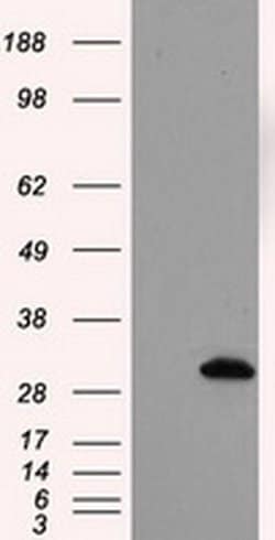 TPMT Monoclonal Antibody (OTI4B1), TrueMAB , OriGene 100 &mu;L; Unconjugated:Antibodies,