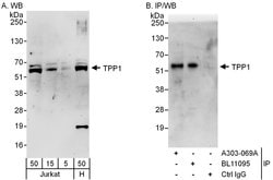 TPP1 Rabbit anti-Human, Polyclonal, Bethyl Laboratories 100 &mu;L; Unconjugated:Antibodies,