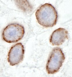 TPR Rabbit anti-Human, Polyclonal, Bethyl Laboratories 100 &mu;L; Unconjugated:Antibodies,