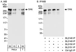 TPR Rabbit anti-Human, Polyclonal, Bethyl Laboratories 100 &mu;L; Unconjugated:Antibodies,