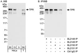 TPR Rabbit anti-Human, Polyclonal, Bethyl Laboratories 100 &mu;L; Unconjugated:Antibodies,