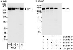 TPR Rabbit anti-Human, Polyclonal, Bethyl Laboratories 100 &mu;l; Unlabeled:Antibodies,