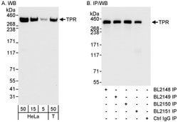 TPR Rabbit anti-Human, Polyclonal, Bethyl Laboratories 100 &mu;L; Unconjugated:Antibodies,