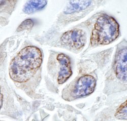 TPR Polyclonal Antibody, Bethyl Laboratories 100 &mu;L; Unconjugated:Antibodies,