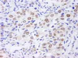TPR Polyclonal Antibody, Bethyl Laboratories 100 &mu;L; Unconjugated:Antibodies,