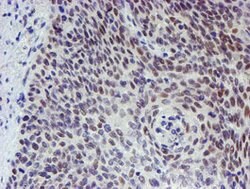 TPRKB Mouse anti-Human, Clone: OTI3E3, lyophilized, TrueMAB 100 &mu;g;