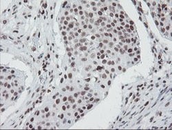TPRKB Mouse anti-Human, Clone: OTI3H3, lyophilized, TrueMAB 100 &mu;g;