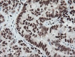 TPRKB Mouse anti-Human, Clone: OTI3H3, lyophilized, TrueMAB 100 &mu;g;