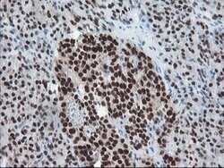 TPRKB Mouse anti-Human, Clone: OTI3H3, lyophilized, TrueMAB 100 &mu;g;