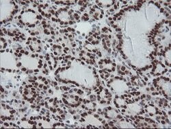 TPRKB Mouse anti-Human, Clone: OTI3H3, lyophilized, TrueMAB 100 &mu;g;