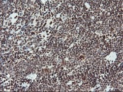 TPRKB Mouse anti-Human, Clone: OTI3H3, lyophilized, TrueMAB 100 &mu;g;