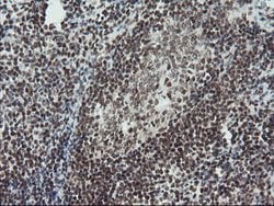 TPRKB Mouse anti-Human, Clone: OTI3H3, lyophilized, TrueMAB 100 &mu;g;