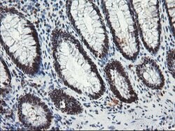 TPRKB Mouse anti-Human, Clone: OTI3H3, lyophilized, TrueMAB 100 &mu;g;