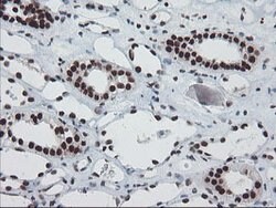 TPRKB Mouse anti-Human, Clone: OTI3H3, lyophilized, TrueMAB 100 &mu;g;