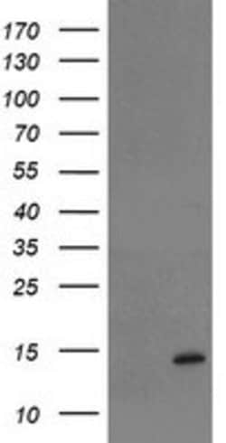 TPRKB Mouse anti-Human, Clone: OTI3E3, lyophilized, TrueMAB 100 &mu;g;