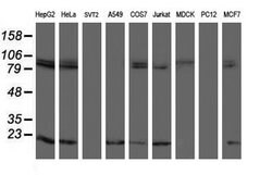 TPRKB Mouse anti-Human, Clone: OTI3H3, lyophilized, TrueMAB 100 &mu;g;