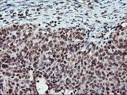 TPSG1 Monoclonal Antibody (OTI1G1), TrueMAB , OriGene 100 &mu;L; Unconjugated:Antibodies,