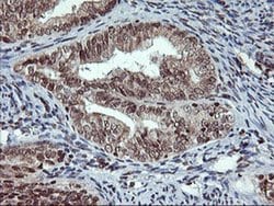 TPSG1 Monoclonal Antibody (OTI1G1), TrueMAB , OriGene 100 &mu;L; Unconjugated:Antibodies,
