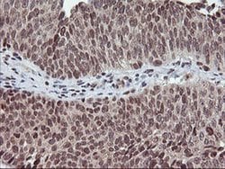 TPSG1 Monoclonal Antibody (OTI1G1), TrueMAB , OriGene 100 &mu;L; Unconjugated:Antibodies,