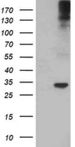 TPSG1 Monoclonal Antibody (OTI1E6), TrueMAB , OriGene:Antibodies:Primary