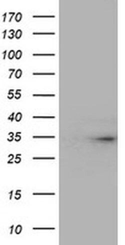 TPSG1 Monoclonal Antibody (OTI3F2), TrueMAB , OriGene:Antibodies:Primary