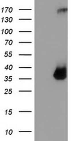 TPSG1 Monoclonal Antibody (OTI1G1), TrueMAB , OriGene 100 &mu;L; Unconjugated:Antibodies,