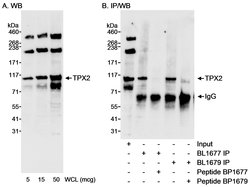 TPX2 Rabbit anti-Human, Polyclonal, Bethyl Laboratories 100 &mu;L; Unconjugated:Antibodies,