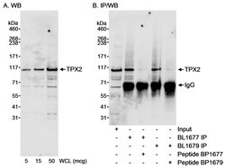 TPX2 Rabbit anti-Human, Polyclonal, Bethyl Laboratories 100 &mu;L; Unconjugated:Antibodies,