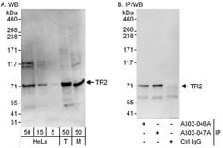 TR2 Rabbit anti-Human, Mouse, Polyclonal, Bethyl Laboratories 100 &mu;L;