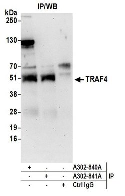 TRAF4 Rabbit anti-Human, Polyclonal, Bethyl Laboratories 100 &mu;L | Buy Online | Bethyl Laboratories, Inc | Fisher Scientific