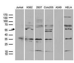 TRAF5 Monoclonal Antibody (OTI7A3), TrueMAB , OriGene:Antibodies:Primary