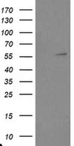 TRAIP Monoclonal Antibody (OTI3E1), TrueMAB , OriGene:Antibodies:Primary