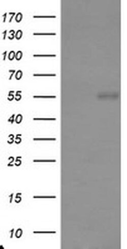 TRAIP Monoclonal Antibody (OTI3A4), TrueMAB , OriGene:Antibodies:Primary