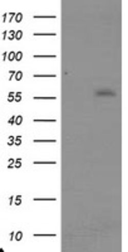 TRAIP Mouse anti-Human, Clone: OTI1G3, lyophilized, TrueMAB 100 &mu;g;