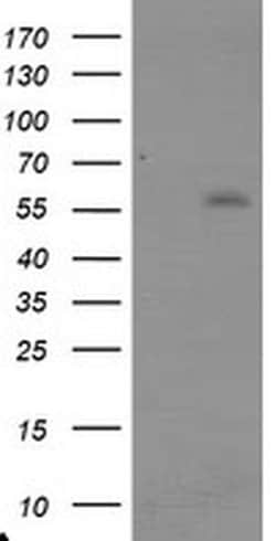 TRAIP Monoclonal Antibody (OTI1G3), TrueMAB , OriGene 100 &mu;L; Unconjugated:Antibodies,
