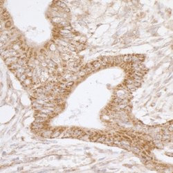 TRAP1/HSP75 Rabbit anti-Human, Mouse, Polyclonal, Bethyl Laboratories 100