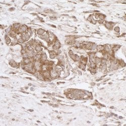 TRAP1/HSP75 Rabbit anti-Human, Mouse, Polyclonal, Bethyl Laboratories 100